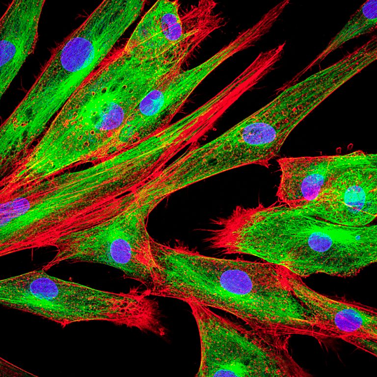 Tumor microenvironment