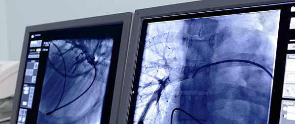 impetus digital - for Clinical Research Organizations